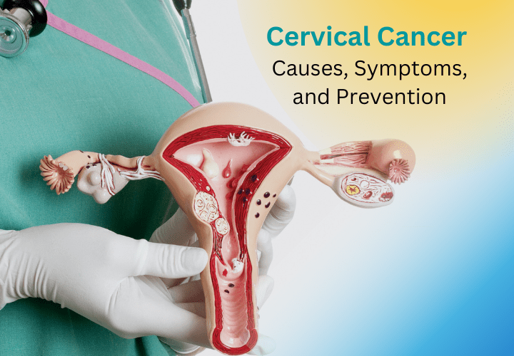 information-on-cervical-cancer