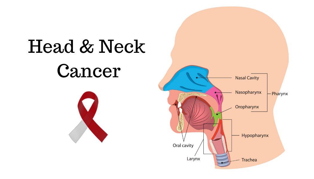 information-on-head-neck-cancers