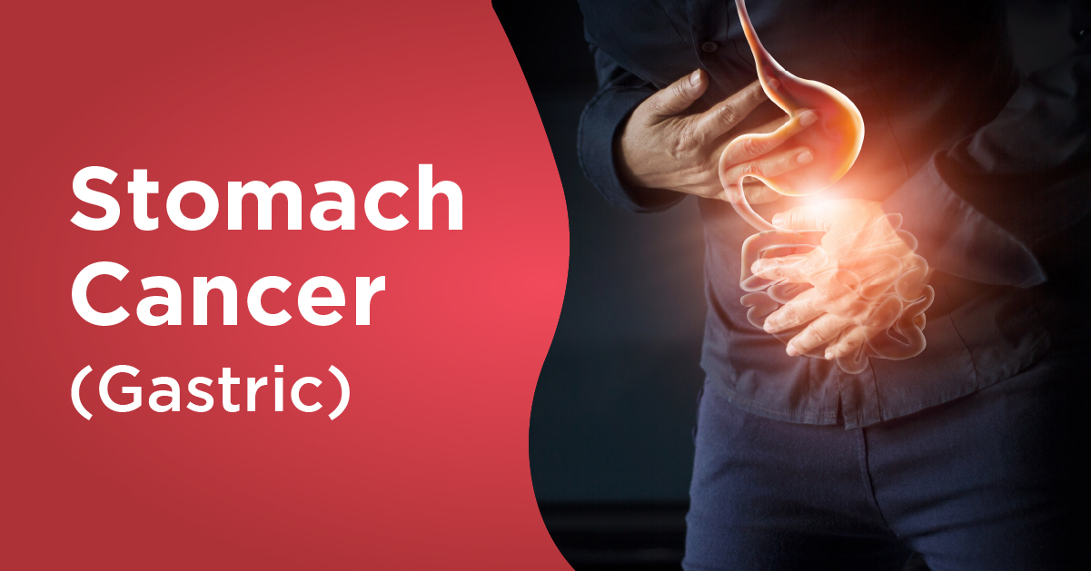 information-on-stomach-gastric-cancer